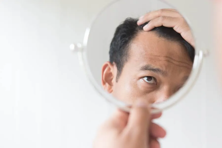 man hair loss looking in mirror